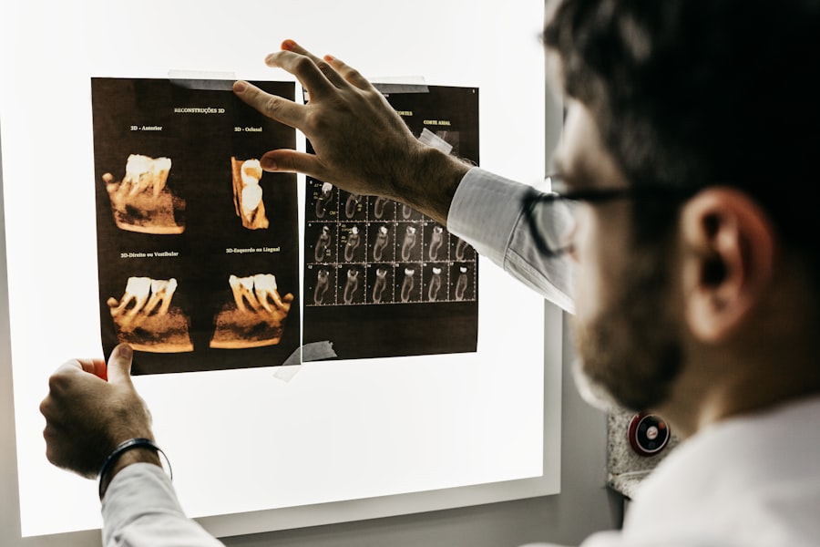 Başarısız implant sonrası hangi adımları atmalısınız?